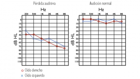 ¿En Que Consiste El Examen De Audiometría? | Audia